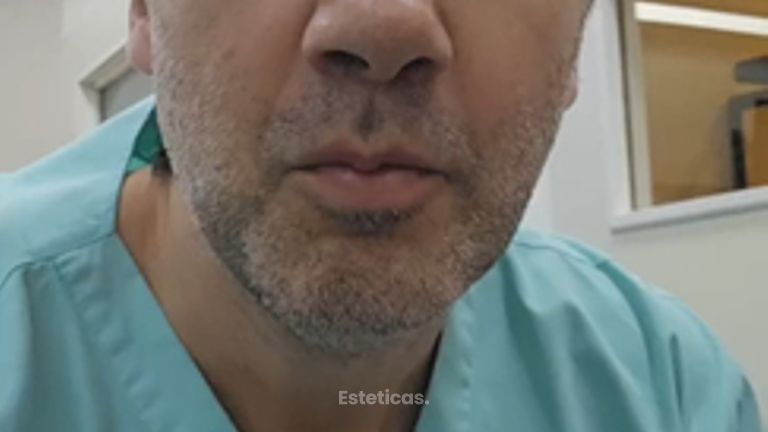 Levantamiento mamario - Dr. Damián Galeazzo y Equipo