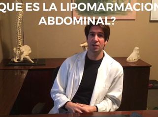Lipomarcación abdominal