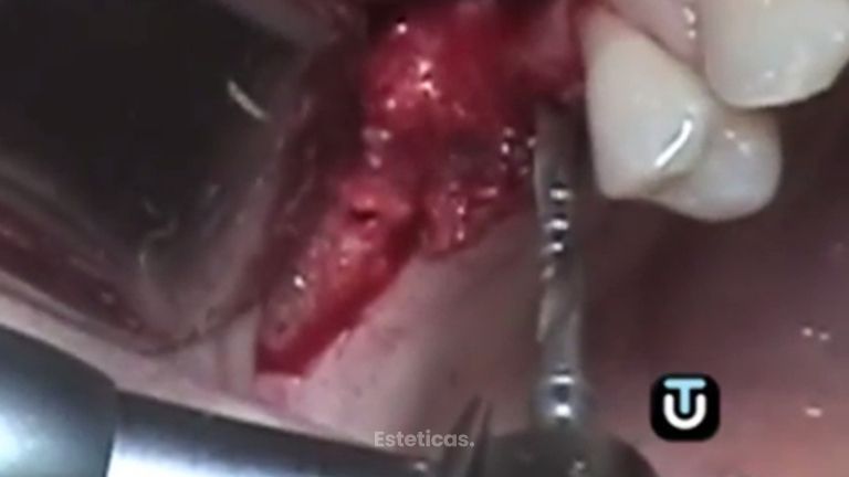 Acaba definitivamente con tus problemas dentales