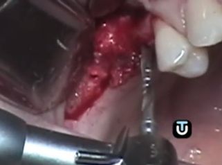 Acaba definitivamente con tus problemas dentales