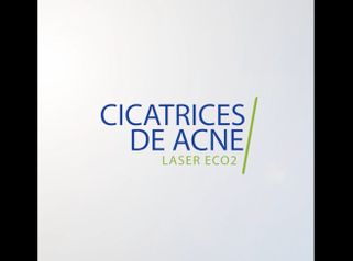 Cicatrices de acné Laser eCO2