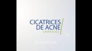 Cicatrices de acné Laser eCO2