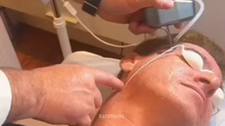 Rejuvenecimiento facial - Dr. Agustín Matia