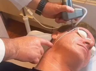 Rejuvenecimiento facial - Dr. Agustín Matia