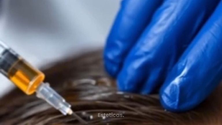 ¿Se te cae el pelo más de lo normal? - Dr. Jose Luis Ava