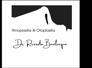 Rinoplastia - Dr. Ricardo Bevilacqua