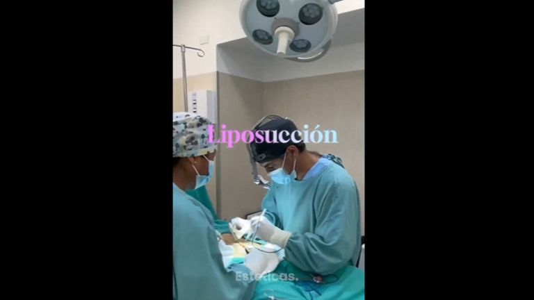 Liposucción - Dr. Diego Cunille