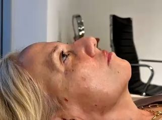 Full Face - Dra. Maria Victoria Rodriguez