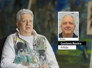 Implante capilar - Experiencia de Gustavo en Medical Hair