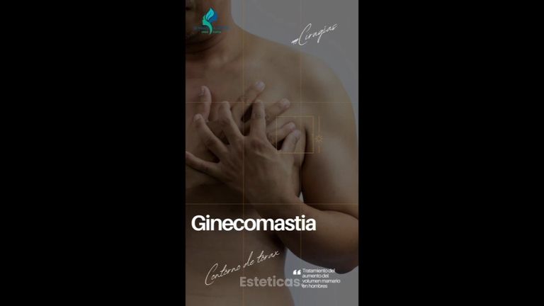 Ginecomastia - Dr. Rodolfo Villavicencio