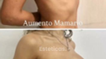 Aumento Mamas - Dra. María de la Paz Vélez