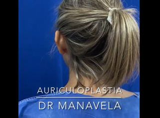 Auriculoplastia - Dr. Emmanuel Manavela Chiapero