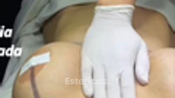 Mastopexia - Dr. Juan Ignacio Balestrelli