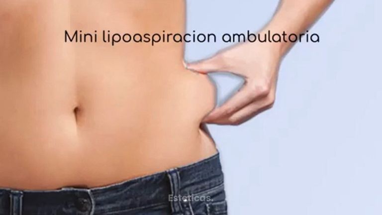 MELA - Mini lipoaspiración ambulatoria - Dra. Paula Granero