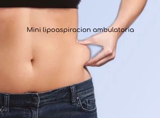 MELA - Mini lipoaspiración ambulatoria - Dra. Paula Granero