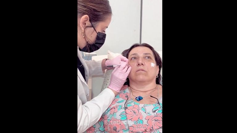 Eliminar ojeras - Dra. Karen Eliana Williams