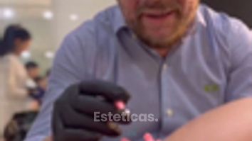 Hilos tensores - Escobar Aesthetic Clinic
