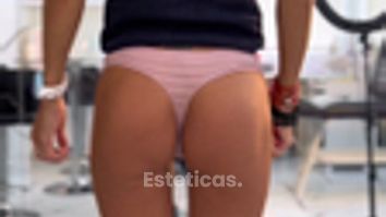 Hilos glúteos - Escobar Aesthetic Clinic