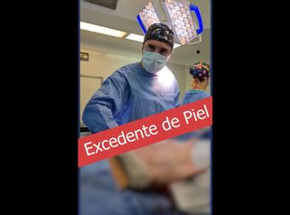 Excedente de piel - Dr. Damián Galeazzo y Equipo