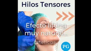 Hilos tensores - Dra. Paula Granero