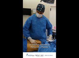 Renuvion J Plasma - Dr. Damián Galeazzo y Equipo