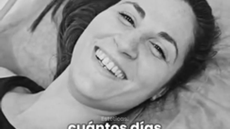 Dermolipectomia Reseña de paciente feliz - Dr. Damián Galeazzo y Equipo