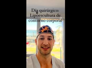 Lipoescultura - Dr. Juan Martín Saá