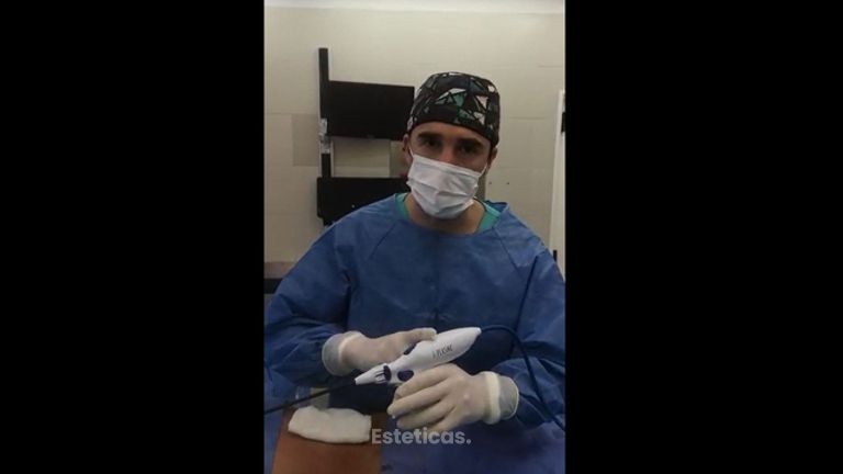 Renuvion J Plasma - Dr. Damián Galeazzo