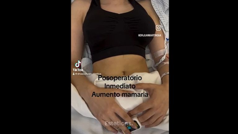 Recuperación mamas - Dr. Juan Martín Saá