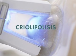 Criolipolisis