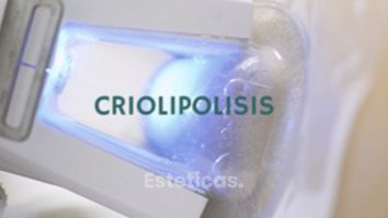 Criolipolisis