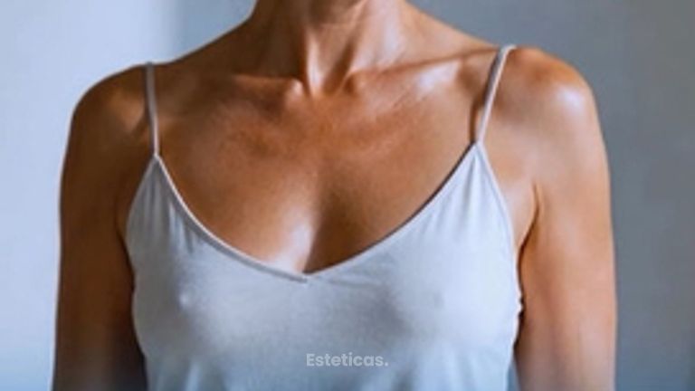 No toda Mastopexia lleva implantes - Dr. Maximiliano Gil Miranda
