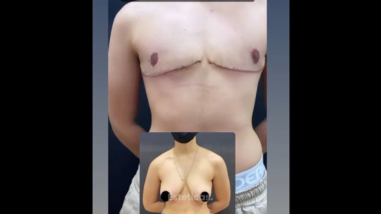 Cambio de sexo - Dr. Emmanuel Manavela Chiapero