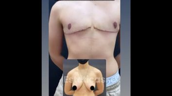 Cambio de sexo - Dr. Emmanuel Manavela Chiapero