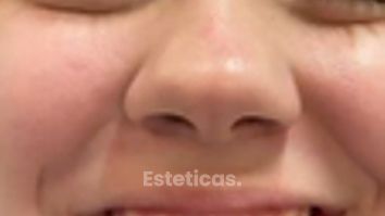 Ortondocia Invisible - Dra. Karina Biondi