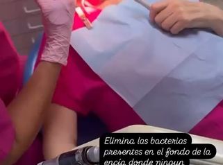 Periodoncia Láser - Dra. Karina Biondi