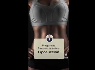Preguntas frecuentes sobre la Liposucción - Dr. Rodolfo Villavicencio