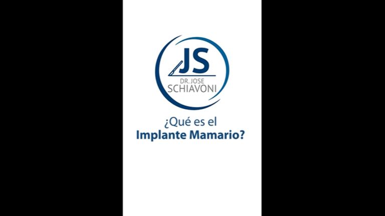Implante mamario - Dr. José María Schiavoni