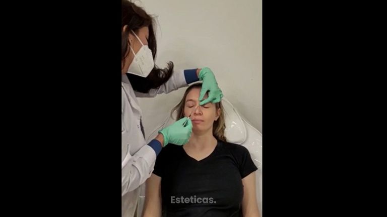 Botox - Dra. Noelia Tarazona Duarte
