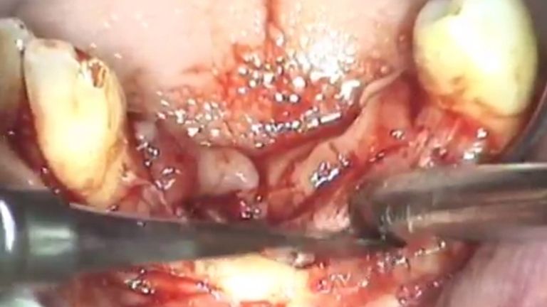 Consigue la máxima salud dental