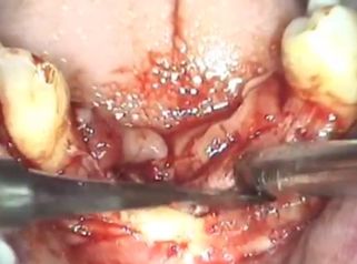 Consigue la máxima salud dental