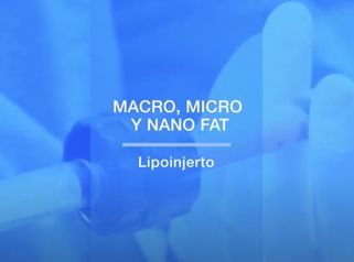 Macro, Micro y Nanofat. Lipofilling  - Dr. Mateo Castro Béduchaud