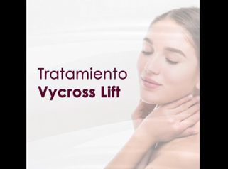 Tratamiento Vycross Lift - Dra. Hebe Blanco