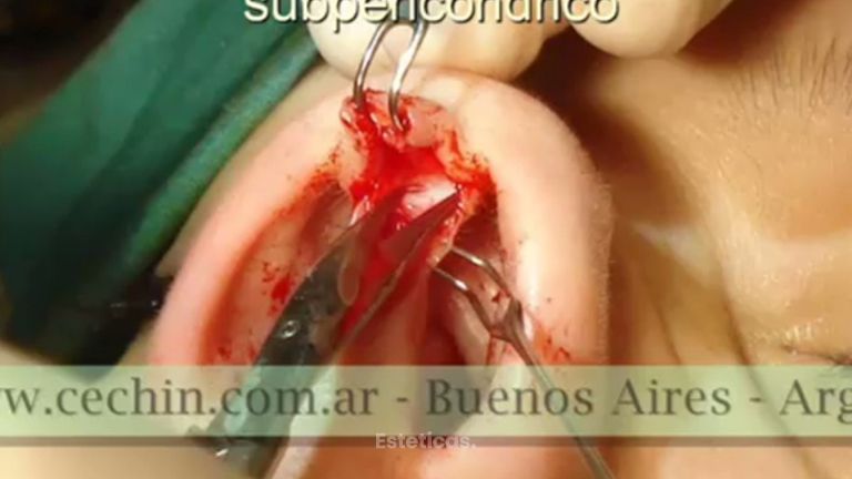 Consigue tu deseado perfil