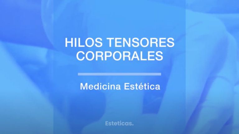 HIlos Tensores Corporales - Dr. Mateo Castro Béduchaud