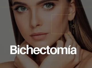 Bichectomia - Dr. Rodolfo Villavicencio