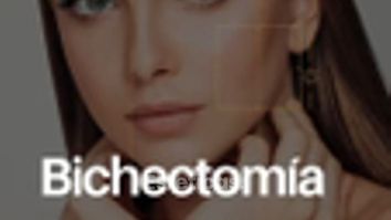 Bichectomia - Dr. Rodolfo Villavicencio