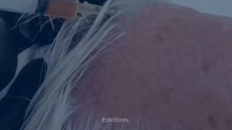 Plasma Rico en Plaquetas - Dr. Damián Wengrowicz