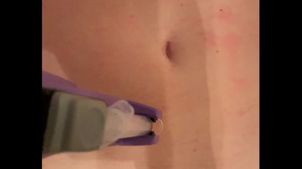 Tratamiento de mesoterapia. Tratamiento de mesoterapia.