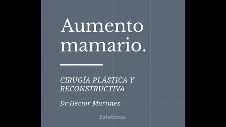 Aumento de mamas - Dr. Héctor Martínez Gomez
